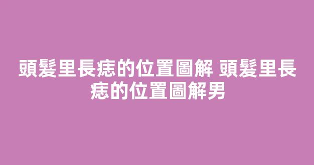 頭髮里長痣的位置圖解 頭髮里長痣的位置圖解男
